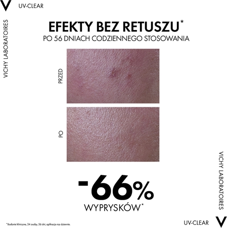 Vichy Capital Soleil UV-Clear pielęgnacja przeciwzmarszczkowa do skóry tłustej ze skłonnością do trądziku