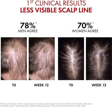 Vichy Dercos Aminexil Clinical vlasový zesilovač pro řídnoucí vlasy