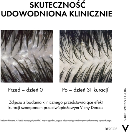 Vichy Dercos Anti-Dandruff szampon z odżywką 2w1 przeciw łupieżowi