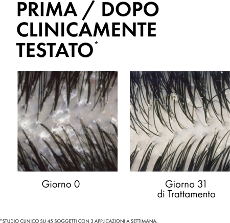 Vichy Dercos Anti-Dandruff shampoo e balsamo 2 in 1 contro la forfora
