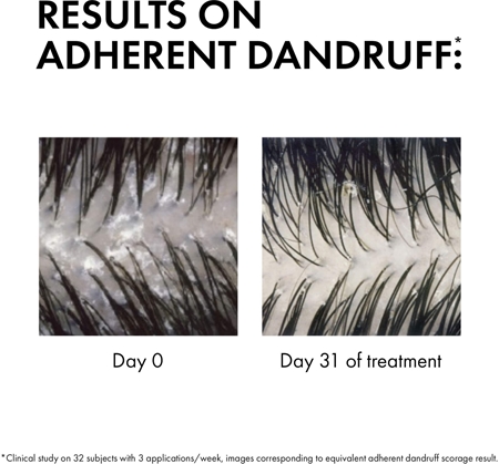 Vichy Dercos Anti-Dandruff šampon protiv peruti za normalnu i masnu kosu