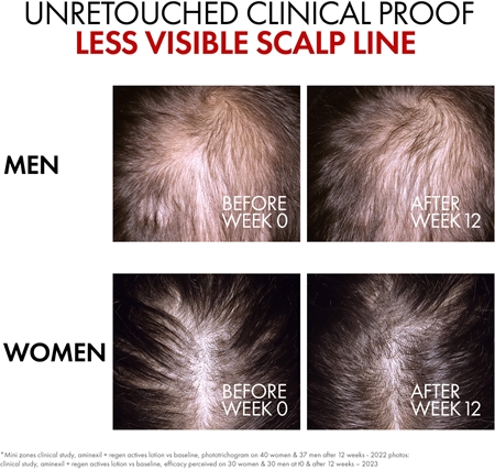 Vichy Dercos Aminexil Clinical REGEN Booster Strengthening and Regenerating Hair Serum for hair loss