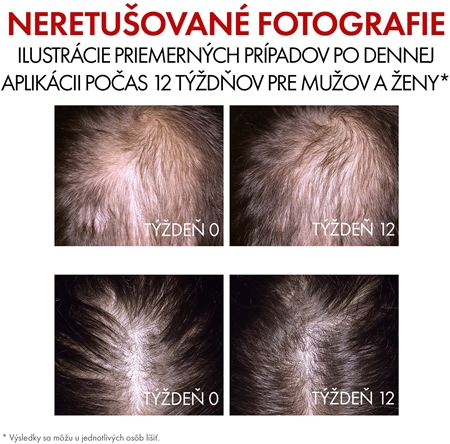 Vichy Dercos Aminexil Clinical REGEN Booster posilňujúce a regeneračné vlasové sérum proti padaniu vlasov