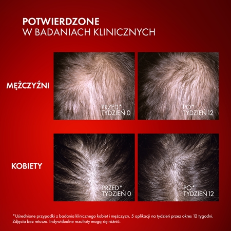 Vichy Dercos Aminexil Clinical REGEN Booster wzmacniające i regenerujące serum do włosów przeciw wypadaniu włosów