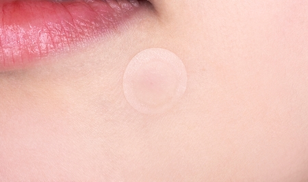 VT Cosmetics Cica Spot Patch flasteri za problematičnu kožu lica