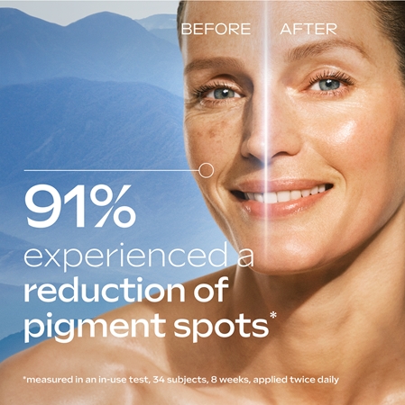 Weleda Blue Gentian & Edelweiss Firming Facial Serum for pigment spot correction