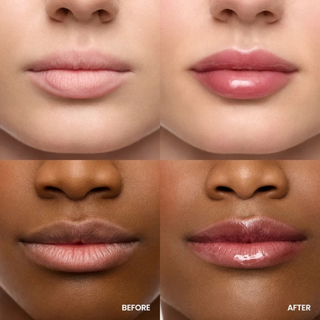 WONDERSKIN Lip Rehab Serum Oil Lip Oil
