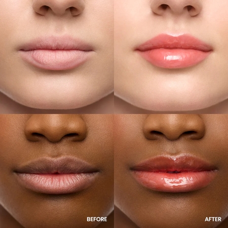 WONDERSKIN Lip Rehab Serum Oil Lip Oil