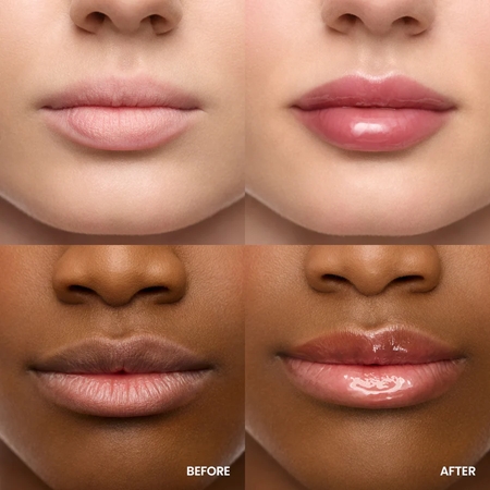 WONDERSKIN Lip Rehab Serum Oil Lip Oil