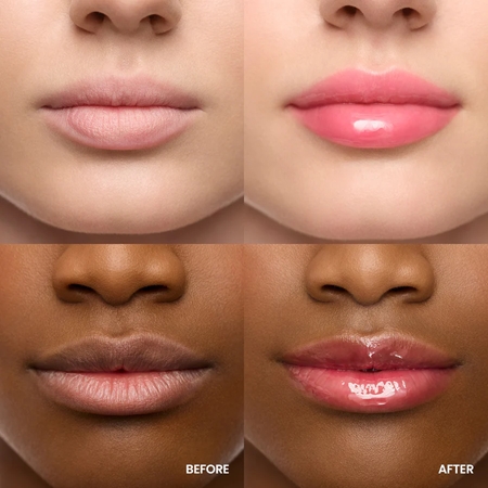 WONDERSKIN Lip Rehab Serum Oil Lip Oil