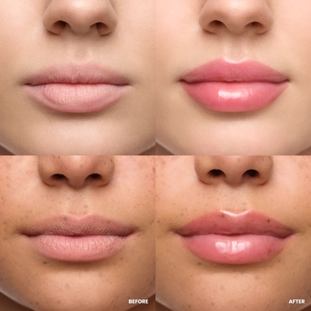 WONDERSKIN Lip Relapse Plumping Gloss Lip Gloss with magnifying effect