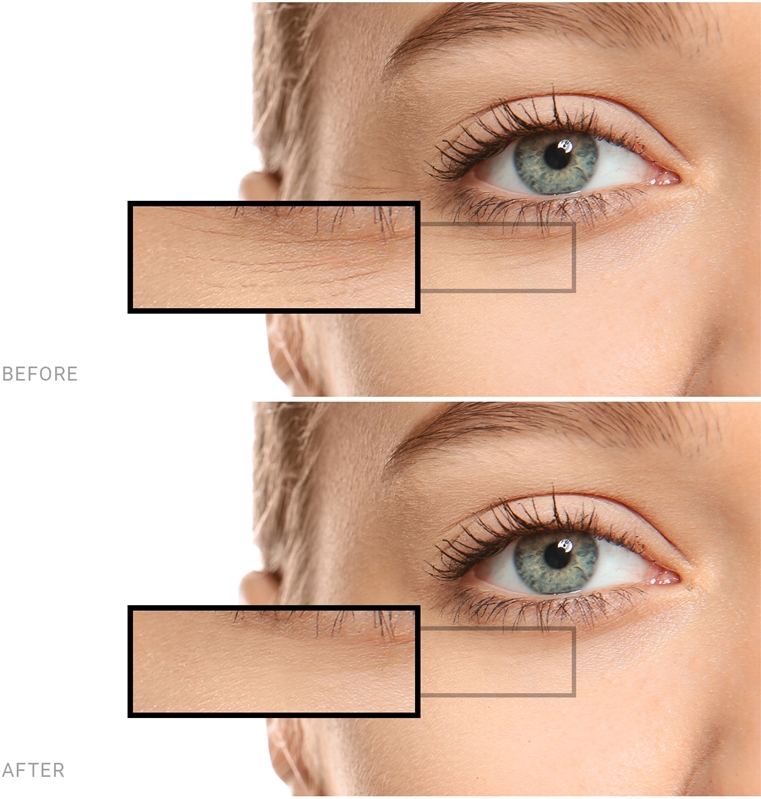 Saffee Advanced Hyaluronic Acid Ampoules 3 dienų pradinės terapijos