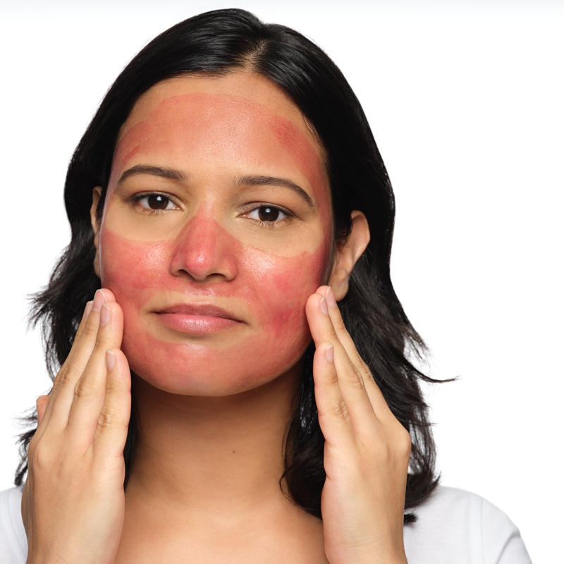 The Ordinary AHA 30% + BHA 2% Peeling Solution Lösung mit Peelingeffekt