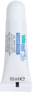 Sebamed Clear Face gél pattanások ellen
