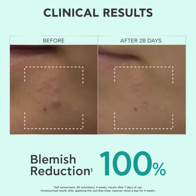 Apivita Just Bee Clear Purifying Cleanser Gel čisticí pleťový gel proti akné 200 ml (obrázek 5)