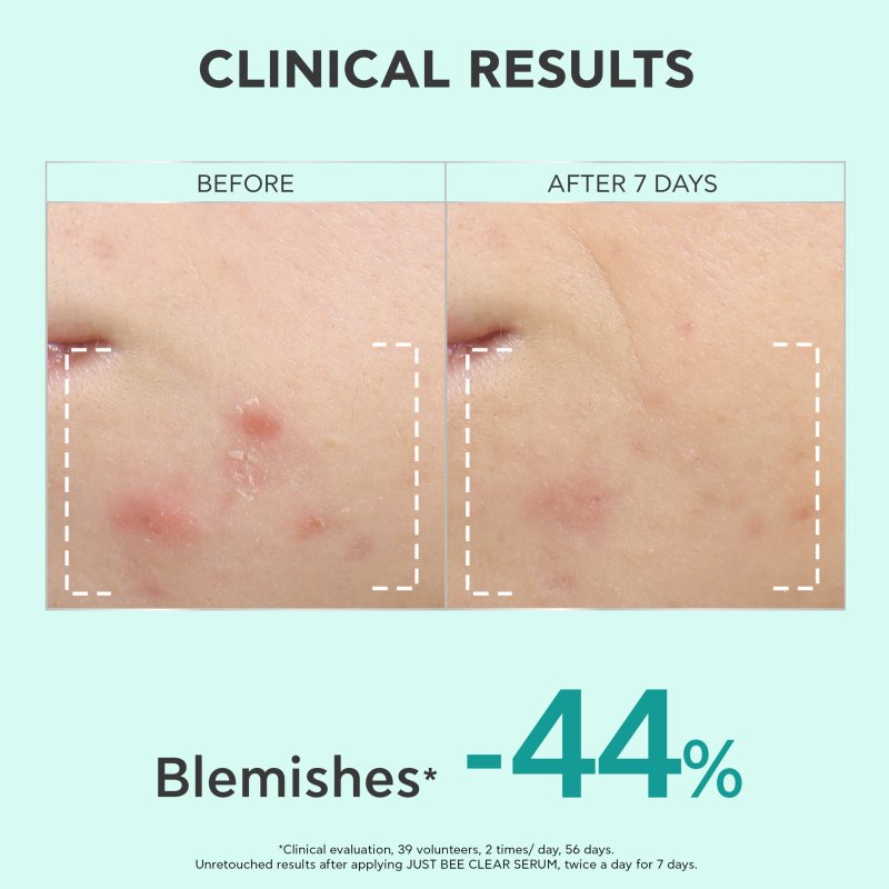 Apivita Just Bee Clear Serum sérum pro mastnou a problematickou pleť 30 ml (obrázek 6)