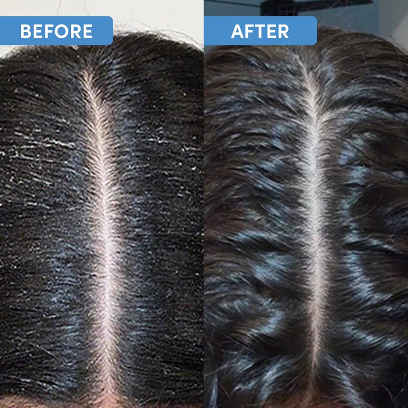 Coco & Eve Youth Revive Scalp Renewal Ensemble Pour Cuir Chevelu