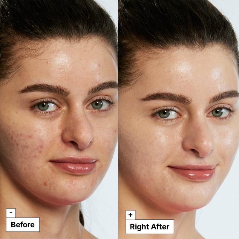Dr. Jart+ Cicapair™ Tiger Grass Color Correcting Treatment intenzivní krém redukující začervenání pleti 50 ml (obrázek 6)