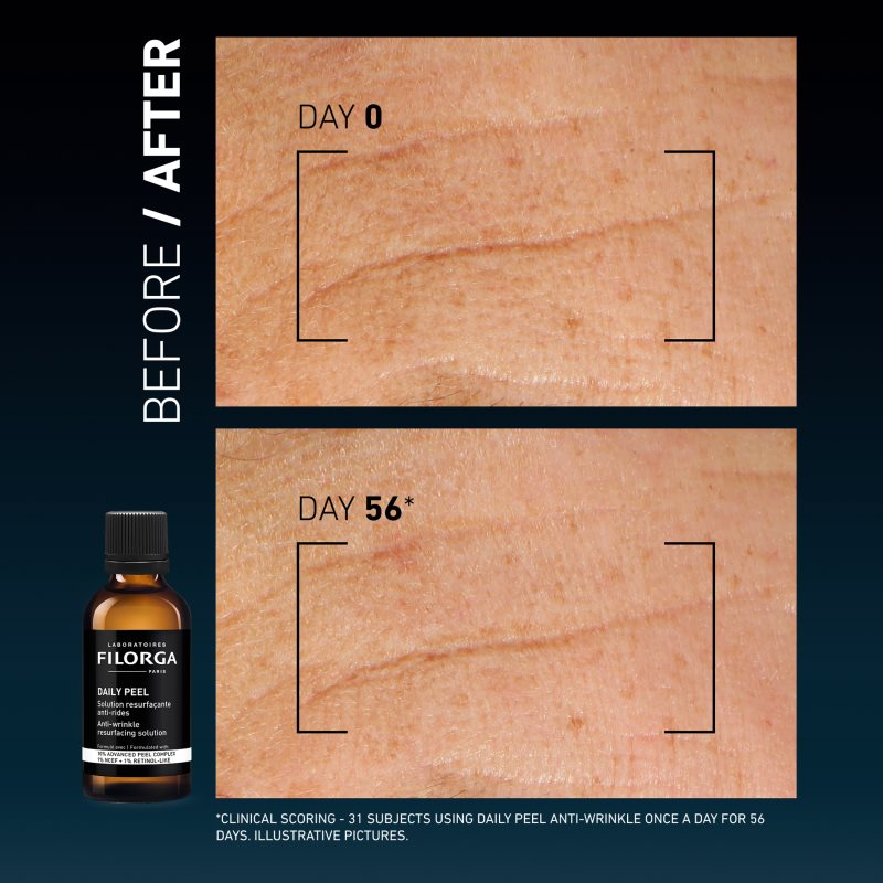 FILORGA DAILY PEEL ANTI-WRINKLE peeling proti vráskám 50 ml (obrázek 7)