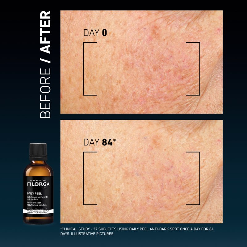 FILORGA DAILY PEEL ANTI-DARK SPOT pleťový peeling proti tmavým skvrnám 50 ml (obrázek 7)