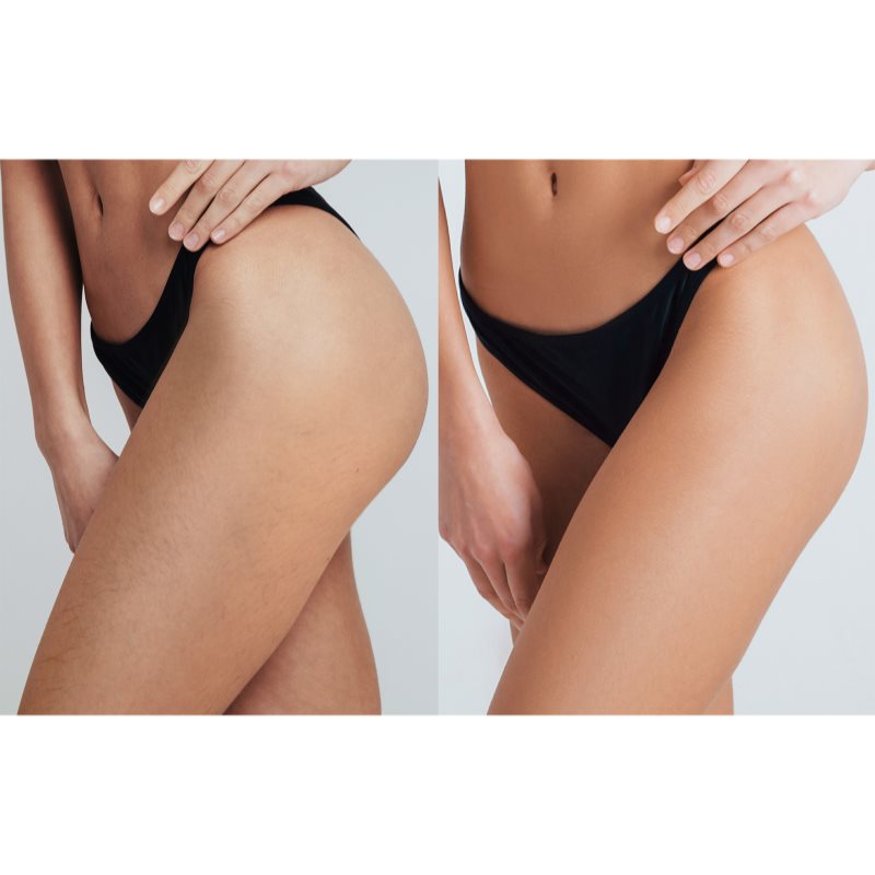 FOREO PEACH 2 Pro Max IPL za telo, obraz, predel bikinija in pazduhe za ženske 1 kos