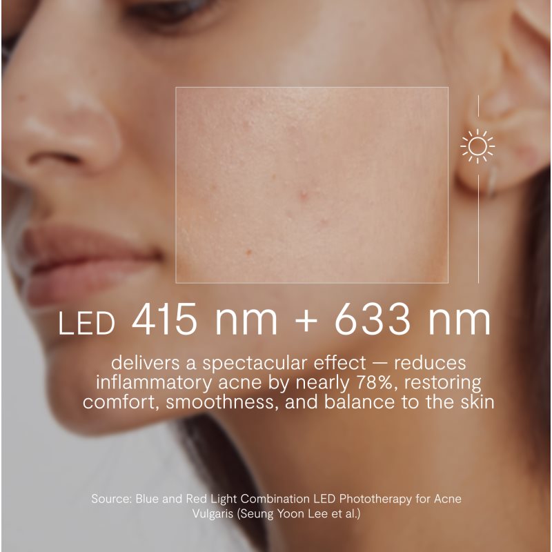 GLOV Supernova Acne Spot Treatment Patch ošetřující LED maska 1 ks (obrázek 4)