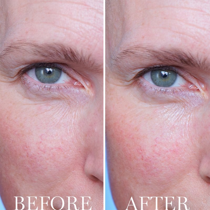 Lancôme Génifique Active Rejuvenating Eye Cream 15 Ml