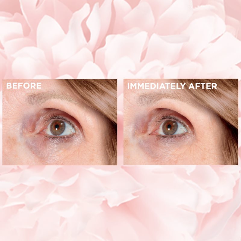 L’Oréal Paris Age Perfect Golden Age Anti-wrinkle Eye Cream For Dark Circles 15 Ml