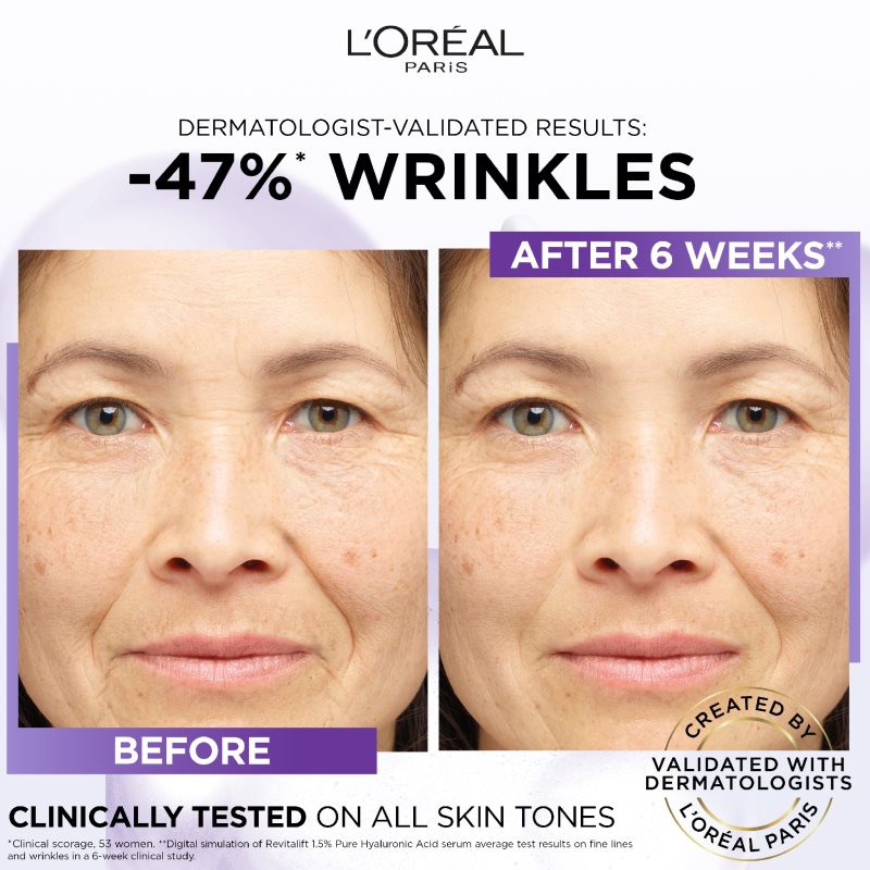 L’Oréal Paris Revitalift Filler Anti-wrinkle Serum With Hyaluronic Acid 30 Ml