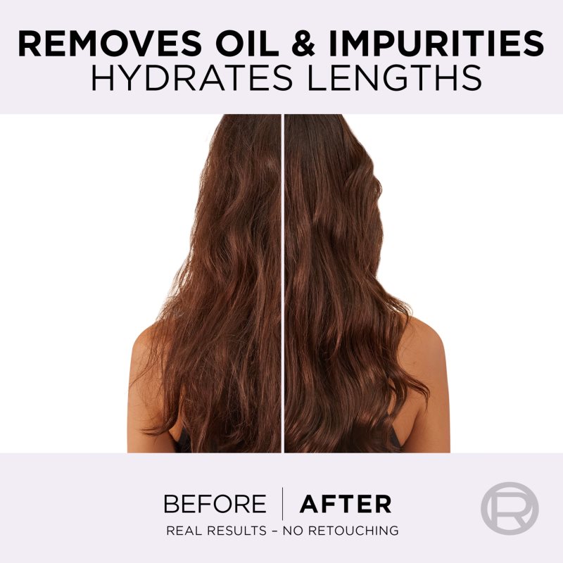 L’Oréal Paris Elseve Hyaluron Pure Shampoing Hydratant Pour Cuir Chevelu Gras Et Pointes Sèches 400 Ml