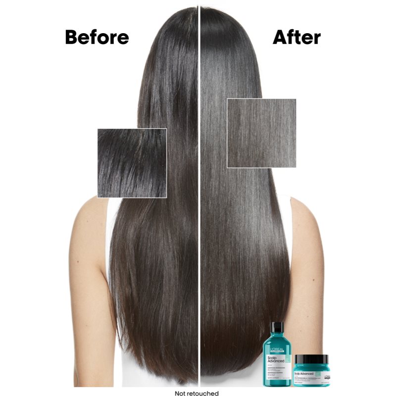 L’Oréal Professionnel Serie Expert Scalp Advanced Shampoing Purifiant Pour Cuir Chevelu Gras 300 Ml