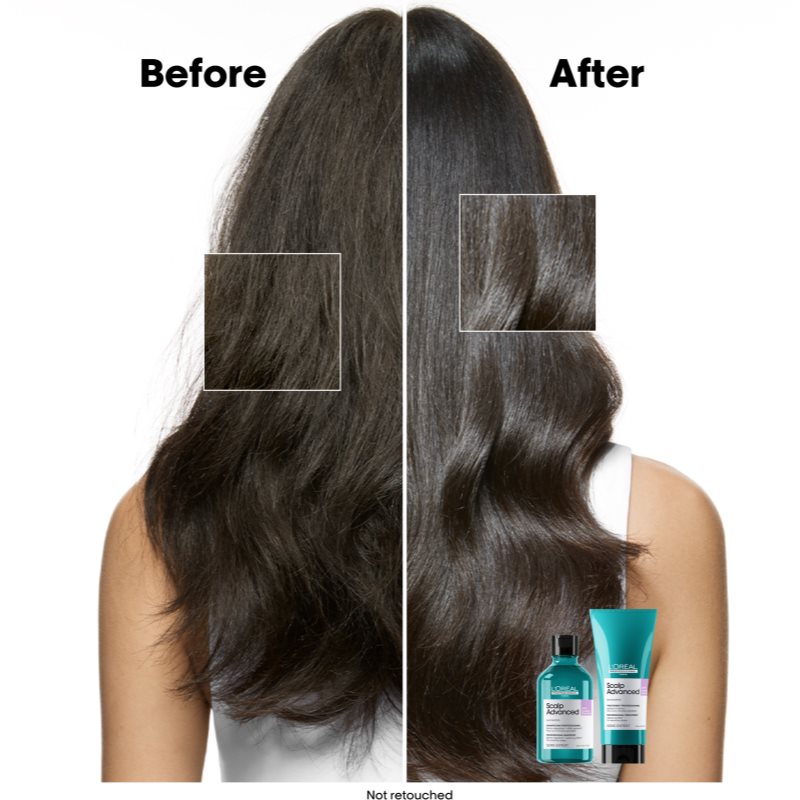 L’Oréal Professionnel Serie Expert Scalp Advanced Shampoing Pour Cuir Chevelu Sensible Et Irrité 500 Ml