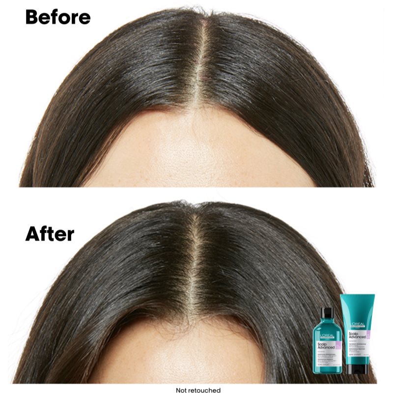 L’Oréal Professionnel Serie Expert Scalp Advanced Shampoing Pour Cuir Chevelu Sensible Et Irrité 500 Ml