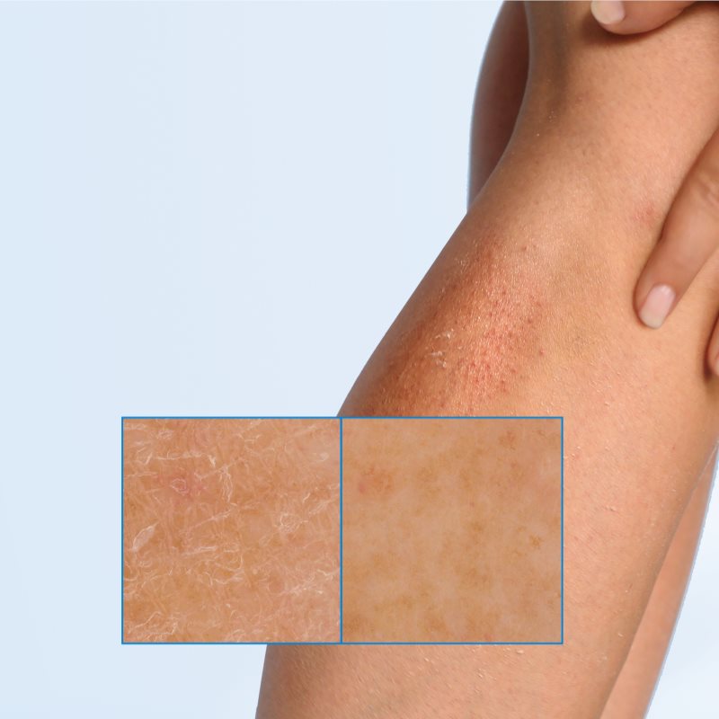 MIXA Ceramide Protect відновлюючий крем для тіла для чутливої шкіри 400 мл
