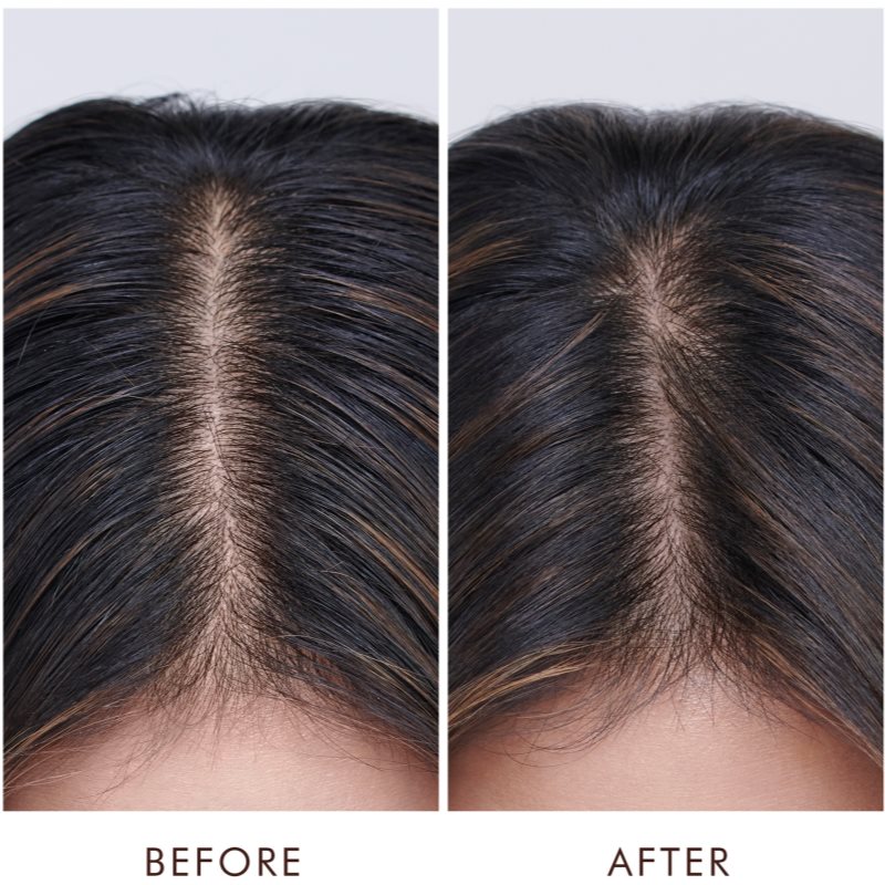 Moroccanoil Treatment Oily сироватка для волосся для жирної шкіри голови 45 мл