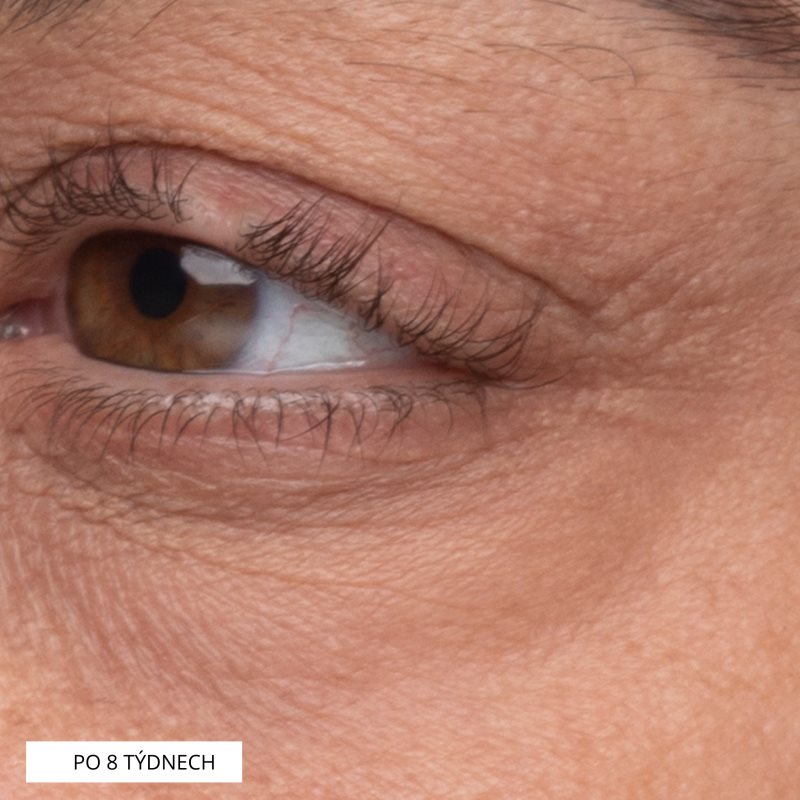 Perricone MD Growth Factor сироватка - ліфтинг  для шкіри навколо  очей 15 мл