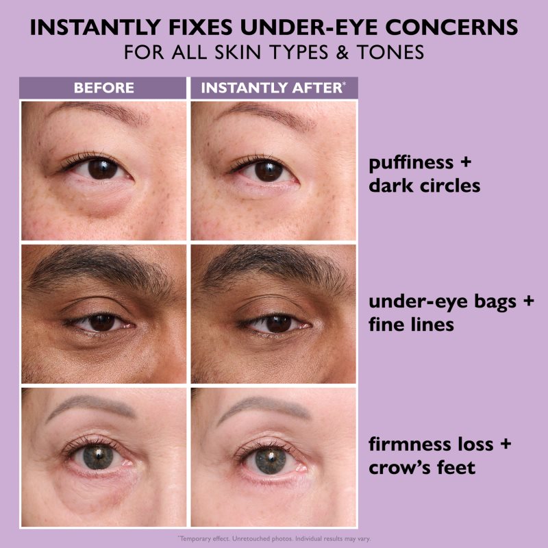 Peter Thomas Roth Instant FIRMx Eye Augencreme zur Verjüngung der Haut 20 ml (Bild 6)
