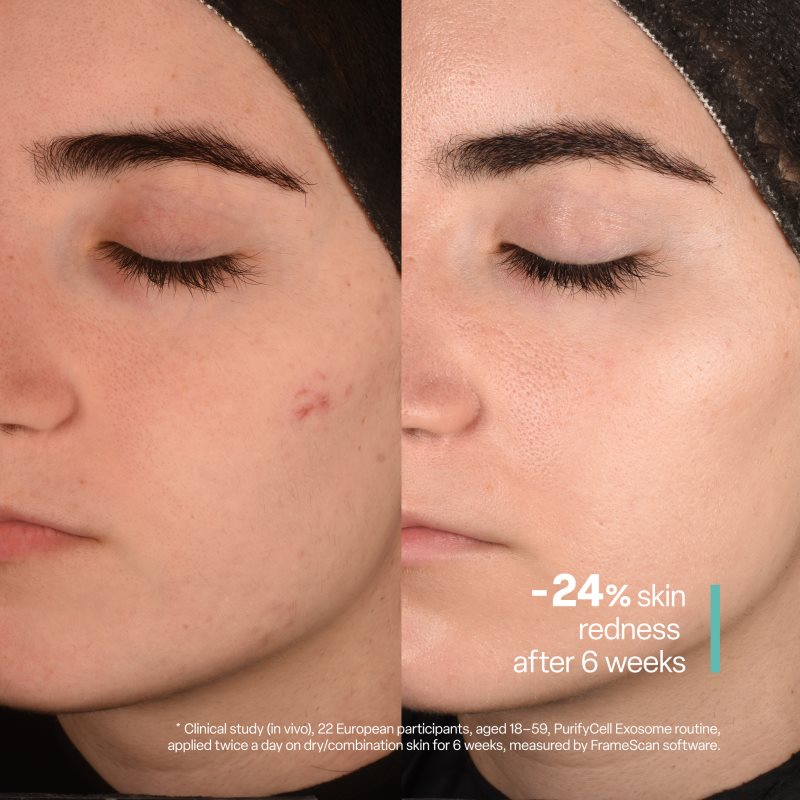 SKINSOO PurifyCell Exosome Cleanser exfoliační čisticí gel 250 ml (obrázek 7)