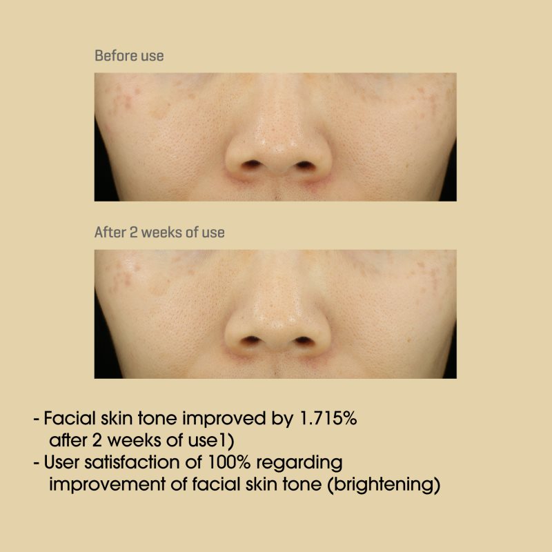 Some By Mi Yuja Niacin Anti Blemish Cream hydratační a rozjasňující pleťový krém pro pleť s hyperpigmentací 60 g (obrázek 8)