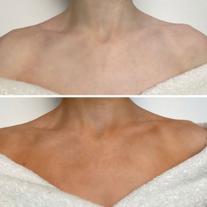 TanOrganic The Skincare Tan Lait Corporel Auto-bronzant Teinte Medium Bronze 100 Ml