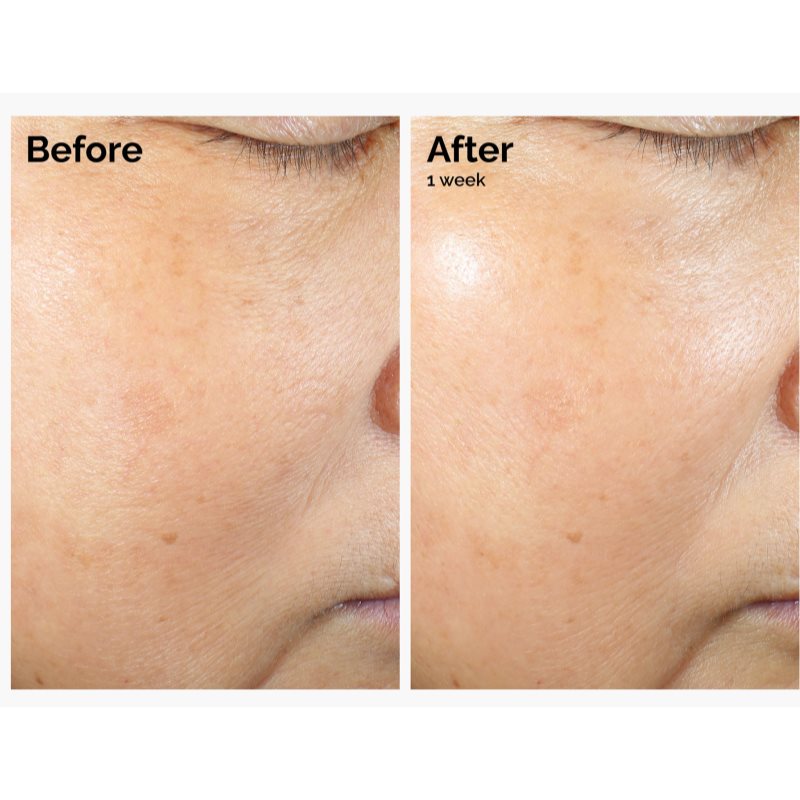 The Ordinary Rice Lipids + Ectoin Microemulsion lehká hydratační emulze pro zklidnění pleti 60 ml (obrázek 3)
