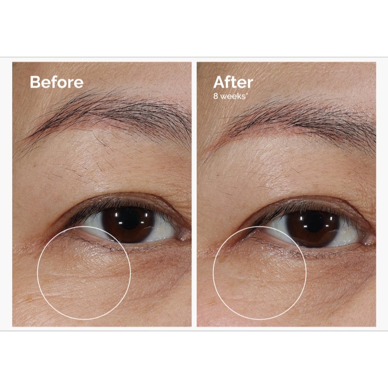 The Ordinary Lacto-PDRN* 4% + B9 Eye Cream vyhlazující oční krém proti vráskám očního okolí 15 ml (obrázek 3)