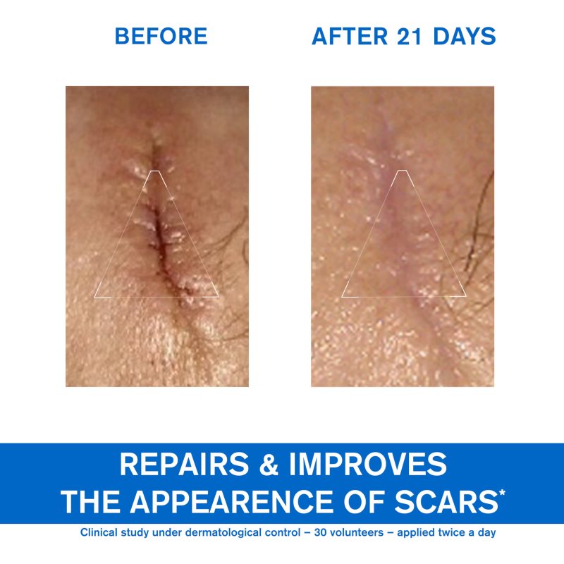 Uriage Bariéderm Cica-Cream with Copper-Zinc Repairing Cream with Cu-Zn 40 ml