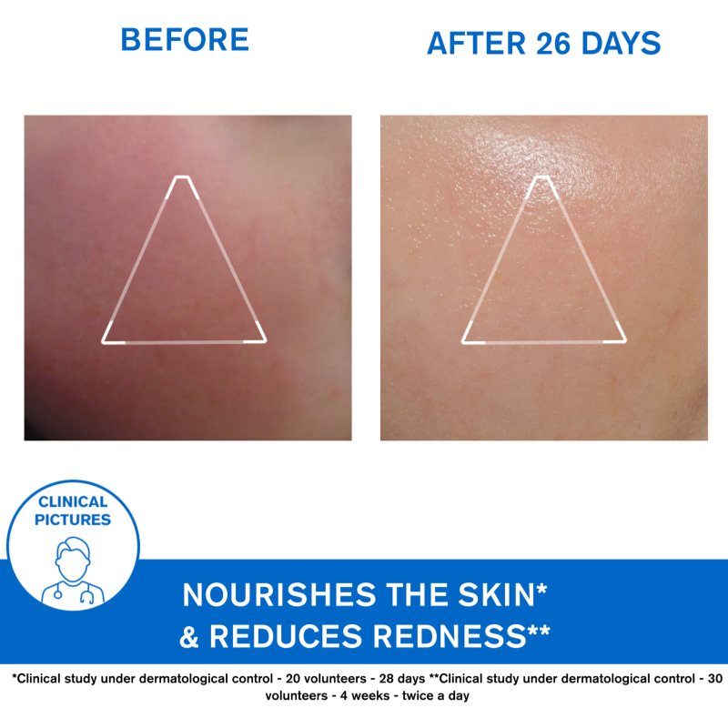 Uriage Xémose Face Cream Crème Nourrissante Pour Peaux Très Sèches Et Sensibles 40 Ml