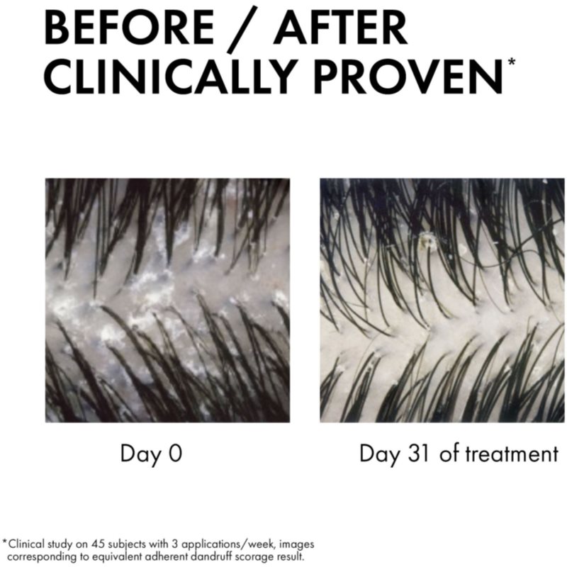 Vichy Dercos Anti-Dandruff Shampoing Et Après-shampoing 2 En 1 Anti-pelliculaire 200 Ml