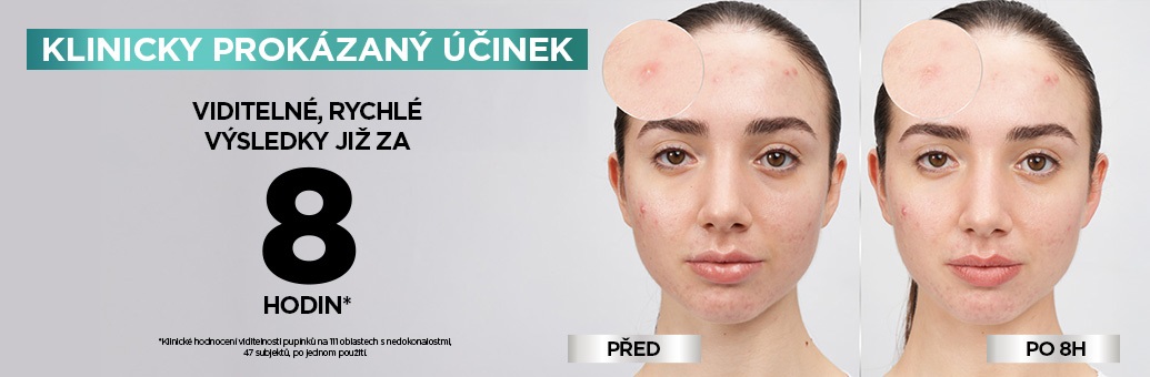 garnier_pimplepatches_02