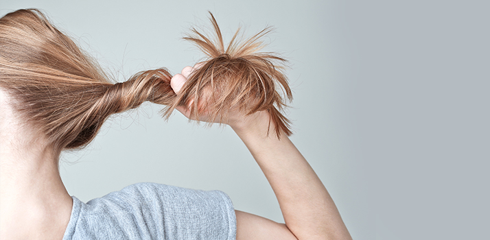 haarausfall was kann man tun notino at