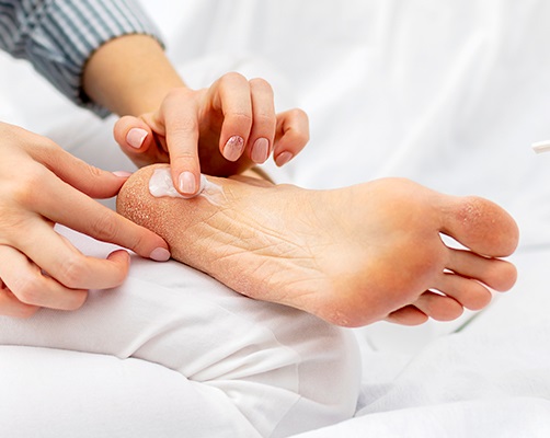Amazon.com: Heel Socks for Dry Cracked Feet Dr.Pedi Moisturizing Socks  Toeless Spa Sock for Foot Care Treatment Gel Socks White : Beauty &  Personal Care