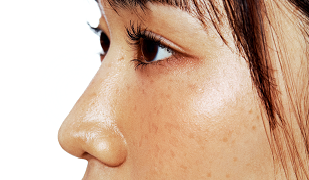 face_20250422_56.
