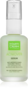MartiDerm Acniover Serum tegen Acne 30 ml